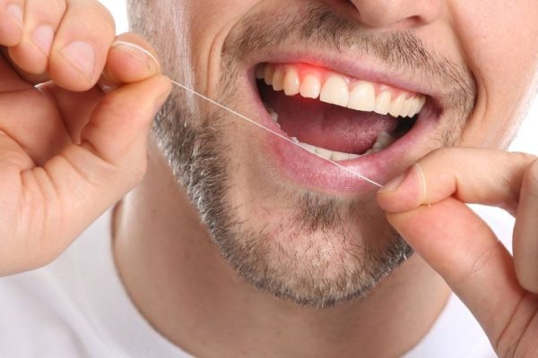 7 Kebiasaan Buruk yang Bisa Merusak Gusi 7 Kebiasaan Buruk yang Bisa Merusak Gusi
