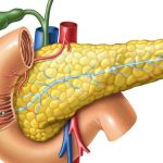 7 Tips Mencegah Pankreatitis Sejak Dini