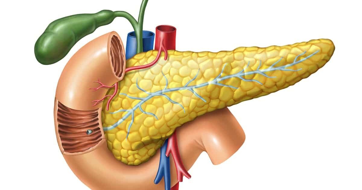 7 Tips Mencegah Pankreatitis Sejak Dini