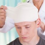7 Langkah Pertolongan Pertama Jika Terjadi Benturan di Kepala