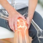 10 Kebiasaan Sehari-hari yang Diam-diam Bikin Lutut Cepat Rusak