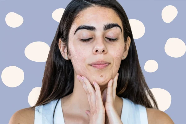 7 Langkah Membersihkan Dagu agar Terhindar dari Iritasi 7 Langkah Membersihkan Dagu agar Terhindar dari Iritasi
