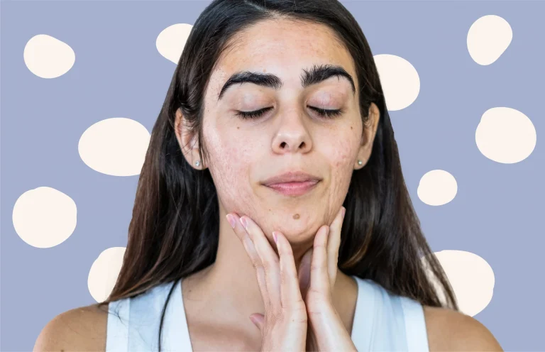 7 Langkah Membersihkan Dagu agar Terhindar dari Iritasi