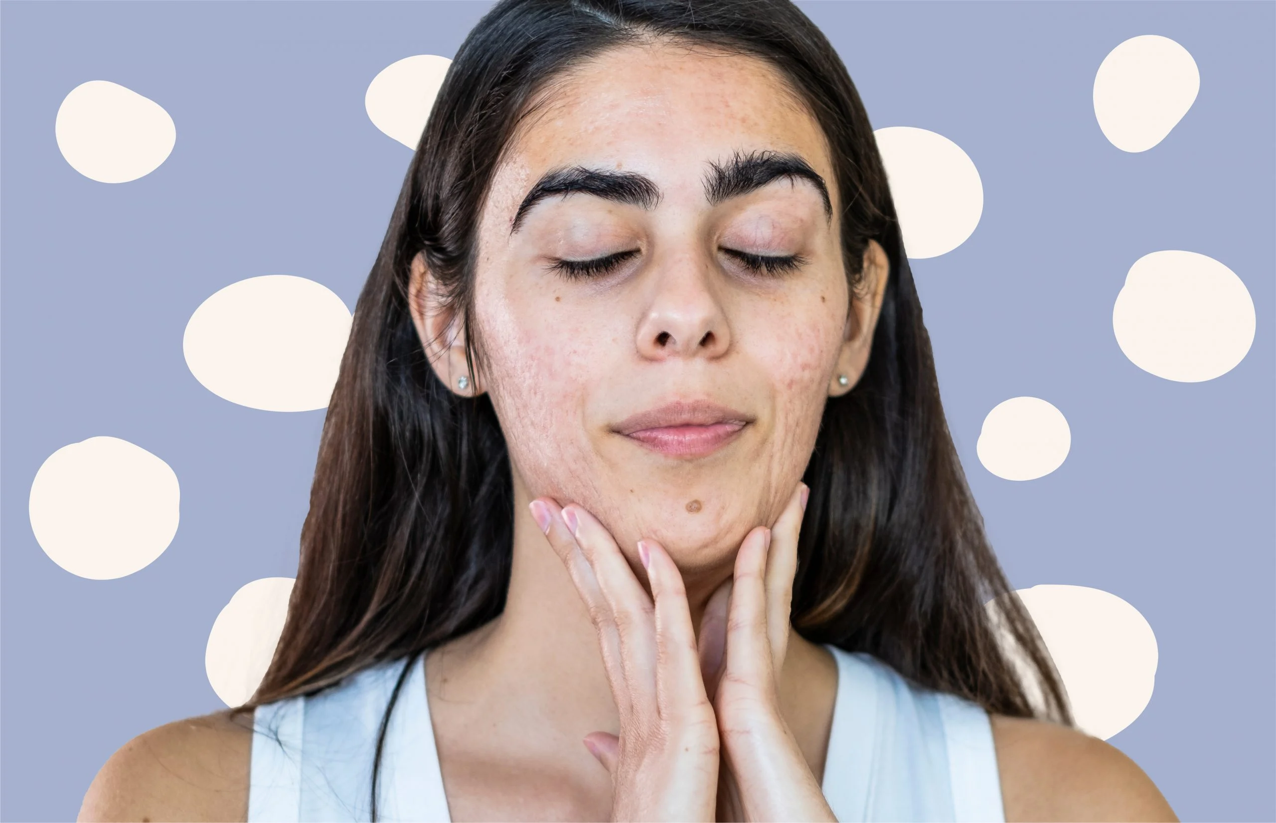 7 Langkah Membersihkan Dagu agar Terhindar dari Iritasi